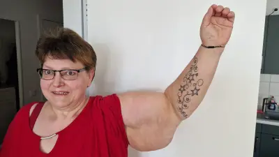 Drillingsmutter Diana (53) erhält unerwartete Hilfe für Lipödem-OP