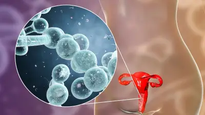 Gynäkologin: Anzeichen einer bakteriellen Vaginose erkennen