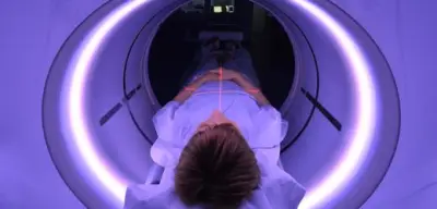 Lungenkrebs-Früherkennung für Starkraucher: Hoffnung und Scham im Fokus