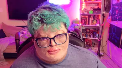 Nur ein Prozent Überlebenschance: Wie ein Horror-Unfall das Leben von Gaming-Influencer Josh für immer veränderte