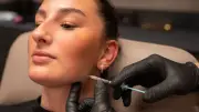 Botox als medizinisches Multitalent: Von Migräne bis Zähneknirschen
