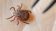Zecken-Alarm in Deutschland: Todesfälle durch Borreliose und FSME steigen deutlich an