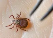 Zecken-Saison in Mecklenburg-Vorpommern: Barmer warnt vor Borreliose-Gefahr