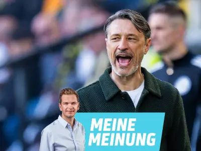 Die Kovac-Debatte ist spektakulär doof und unbegründet