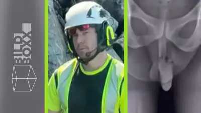 Peinlicher Video-Patzer: Röntgenbild zeigt mehr als nur das Knie