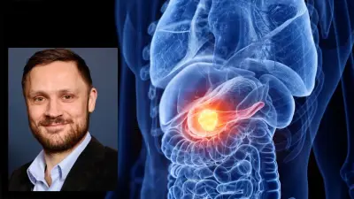 Riesen-Durchbruch bei Bauchspeicheldrüsenkrebs: Neue Pille Daraxonrasib