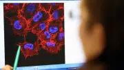 Hautkrebsscreening: Patienten müssen bald selbst zahlen