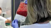Mehr als Globuli: Diese erstaunlichen Extras zahlen Krankenkassen