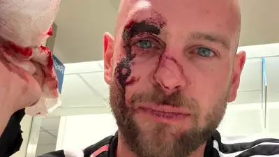 DFB-Fan in Toronto wegen Regenbogen-Fächer verprügelt: „Attacke war homophob“