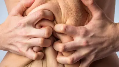 Schlaffe Haut nach Abnehmspritze: Wann die Kasse zahlt