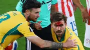 Blut-Schock für Bundesliga-Star: Metcalfe mit Platzwunde bei WM