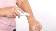 Stichheiler im Test: Diese Gadgets lindern Mückenstiche effektiv