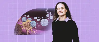 CAR-T-Zelltherapie: Hoffnung auch für solide Tumore – Charité-Expertin im Interview