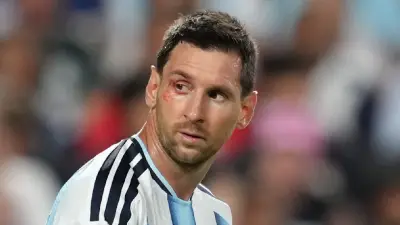WM 2026: Argentinien im Halbfinale – Messi mit blutender Wunde