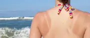 Dermatologin über Botox, Sonnenbrand und Melkfett: „Sind Sie ein entzündeter Euter oder ein Mensch?“