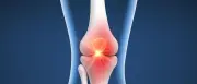 Durchbruch bei Arthrose: Stanford verjüngt Knorpelzellen mit Wirkstoff