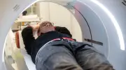 Ex-Raucher im Lungenkrebs-Screening: Angst vor Tumor-Diagnose