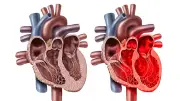 Happy-Heart-Syndrom: Zu viel Glück kann das Herz brechen