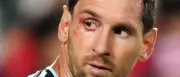 Messi: „Sprich mich höflich an“ – Ansage an Schiedsrichter bei WM