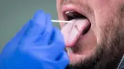 Neuer Bürstentest erkennt Mundkrebs in einer Stunde – Biopsie vermeidbar