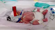 Seltene Geburt in Australien: Eineiige Vierlinge in Brisbane