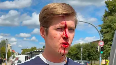 AfD-Politiker Schumann bei Demo in Schwerin angegriffen und verletzt